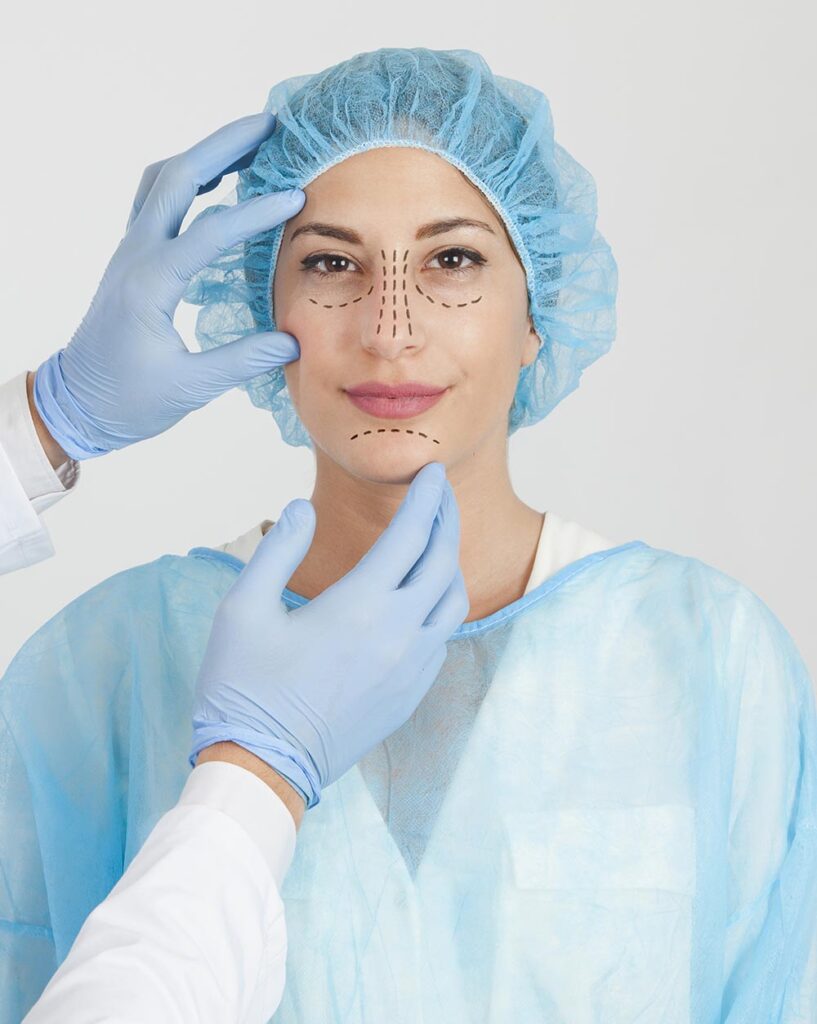 Why Do Celebrities Choose Rhinoplasty?